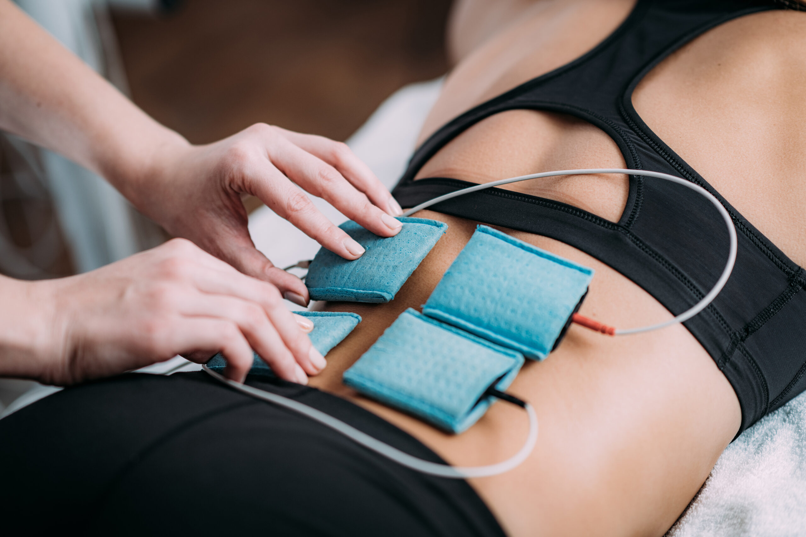 TENS, Transcutaneous Electrical Nerve Stimulation in Physical Therapy. Therapist Positioning Electrodes onto Patient's Lower Back